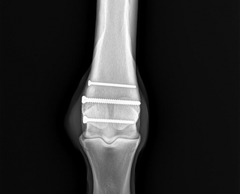 pinned fracture party business xray showing the pinned fracture to party business' off hind